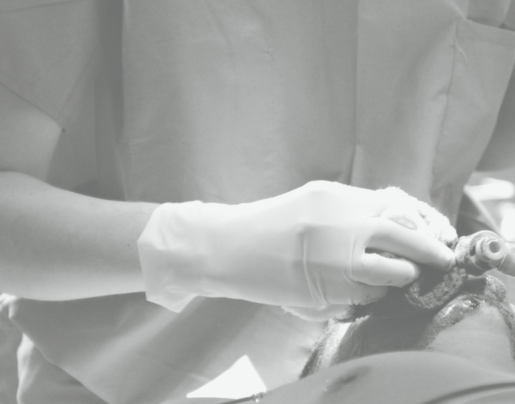 ventilating a patient during anaesthesia